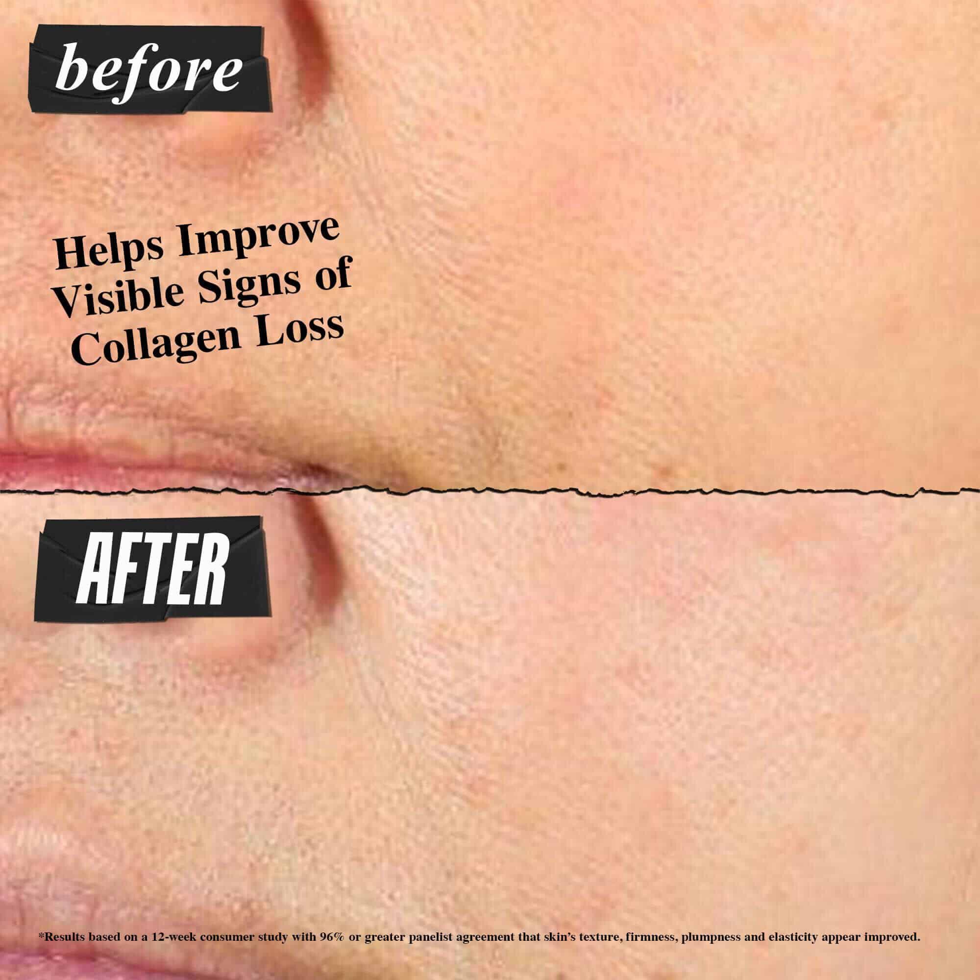 Снимка "Преди и След" – Kiehl's Super Multi-Corrective Cream помага за подобряване на видимите признаци на загуба на колаген