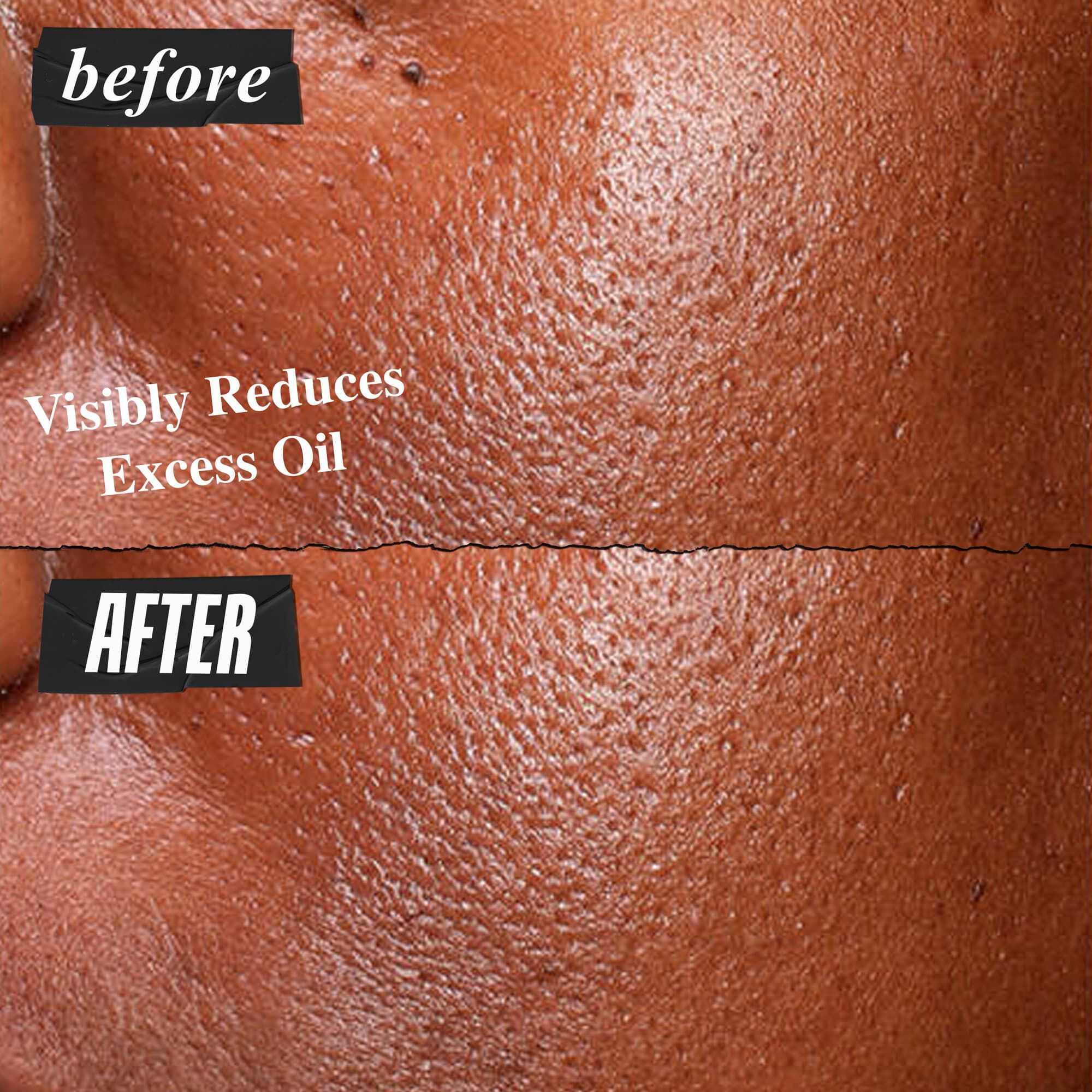 Снимка "Преди и След" на висококонцентрирания серум Kiehl's Ultra Pure, който видимо намалява излишния себум