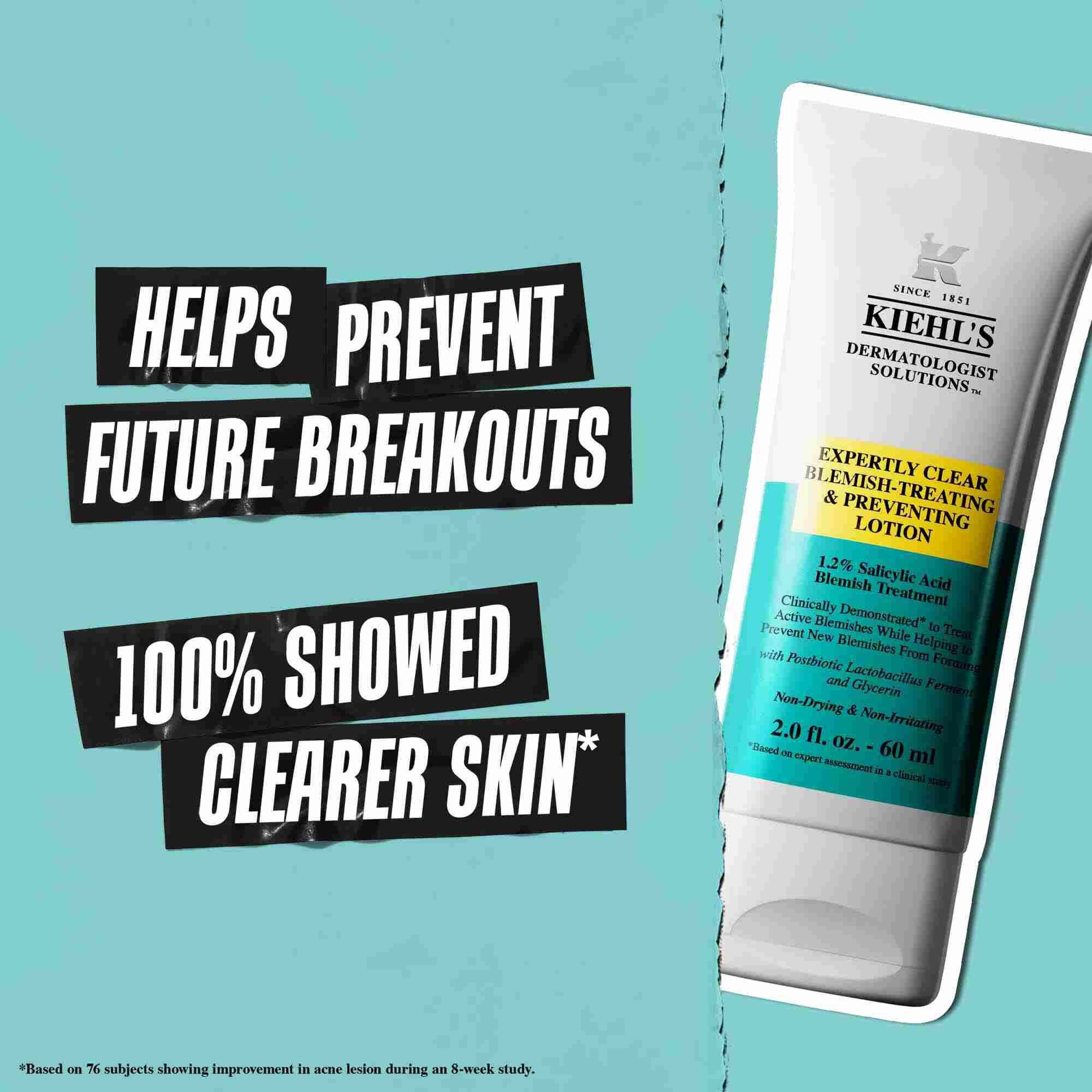 Туба Expertly Clear Blemish-Treating & Preventing Lotion на син фон с текст: „Помага за предотвратяване на бъдещи обриви“ и „100% показват по-чиста кожа“.