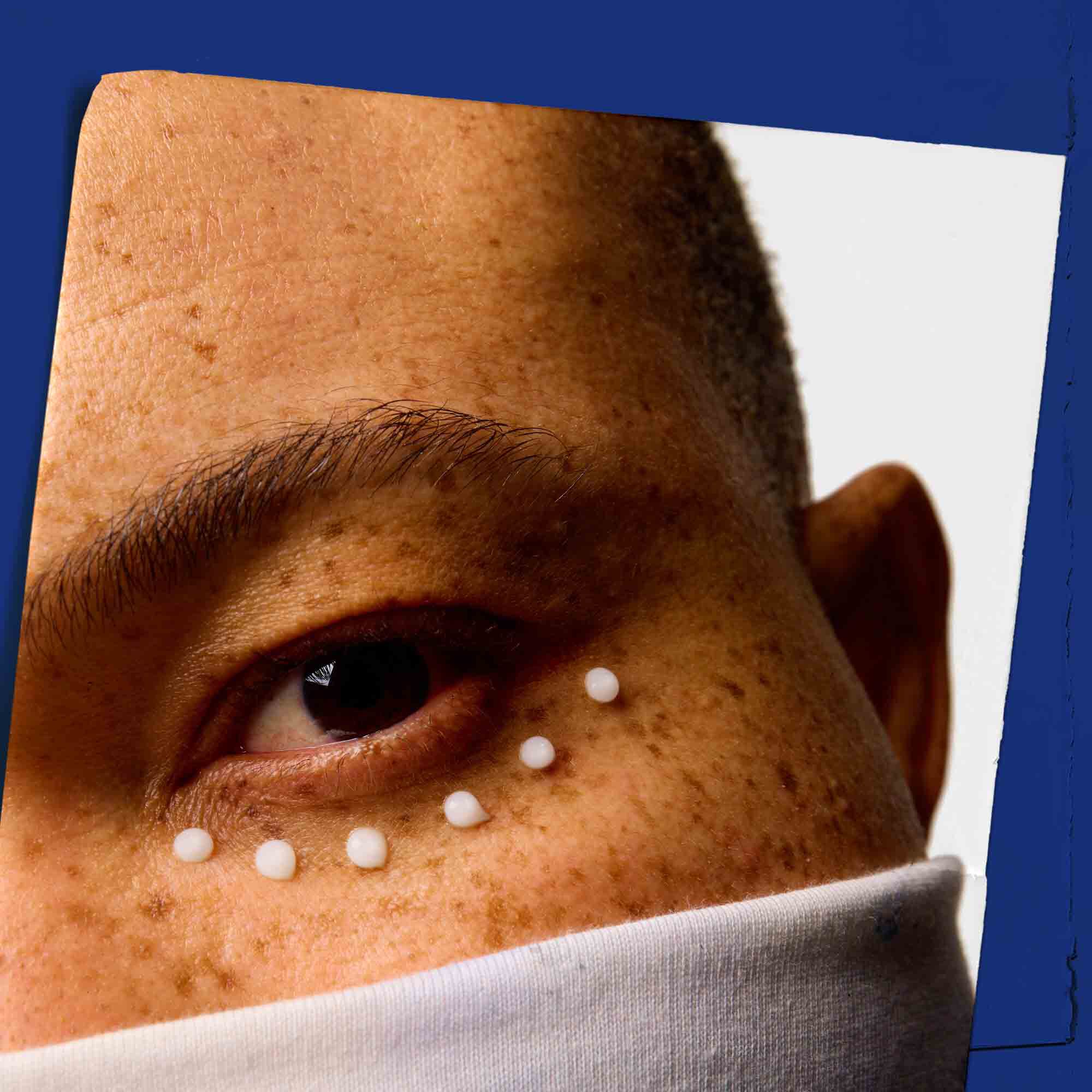 Близък план на кожата около очите, с точки от Facial Fuel Eye Fuel.