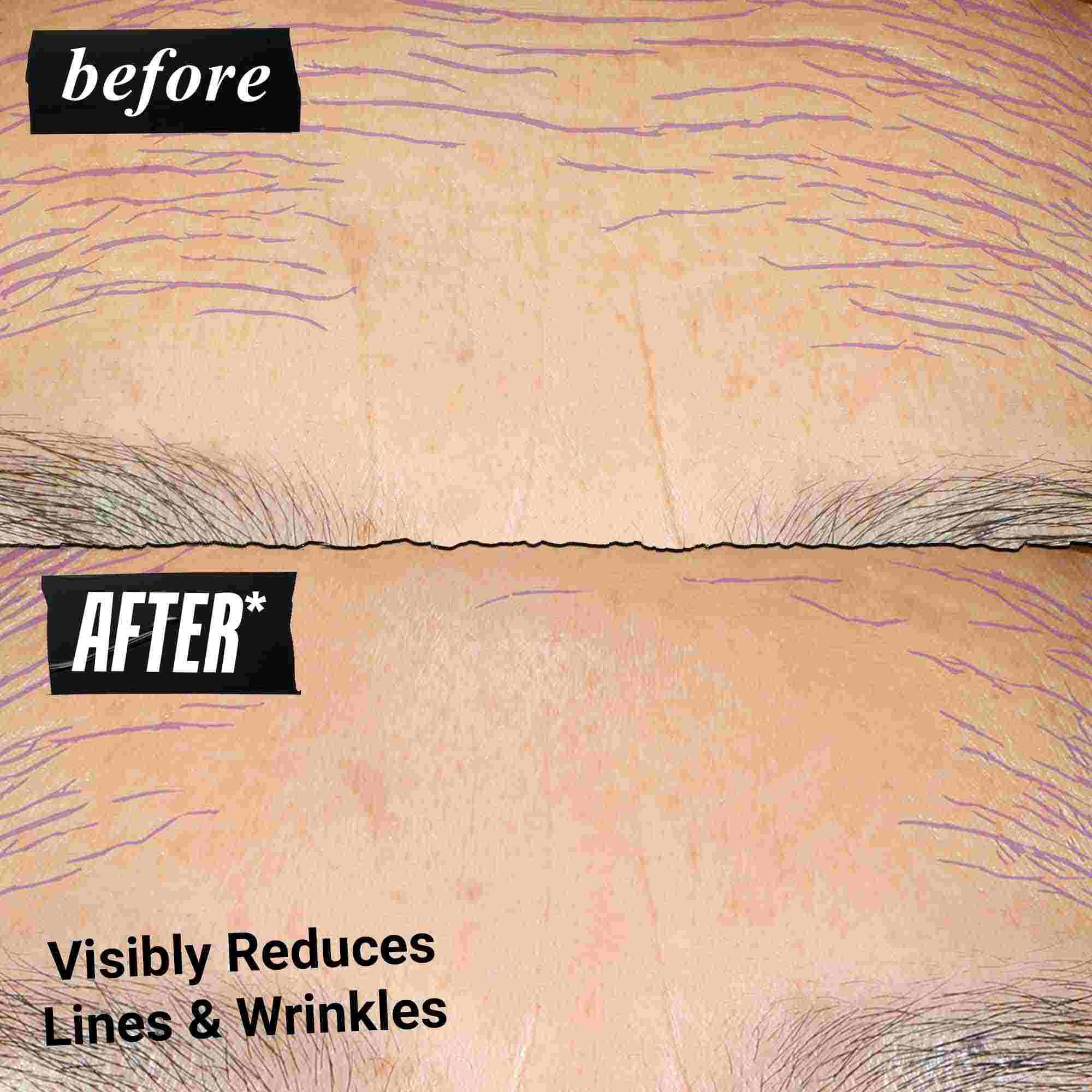 Снимка "Преди и След" – Kiehl's Retinol Skin Renewing Daily Microdose помага за подобряване на тена и текстурата