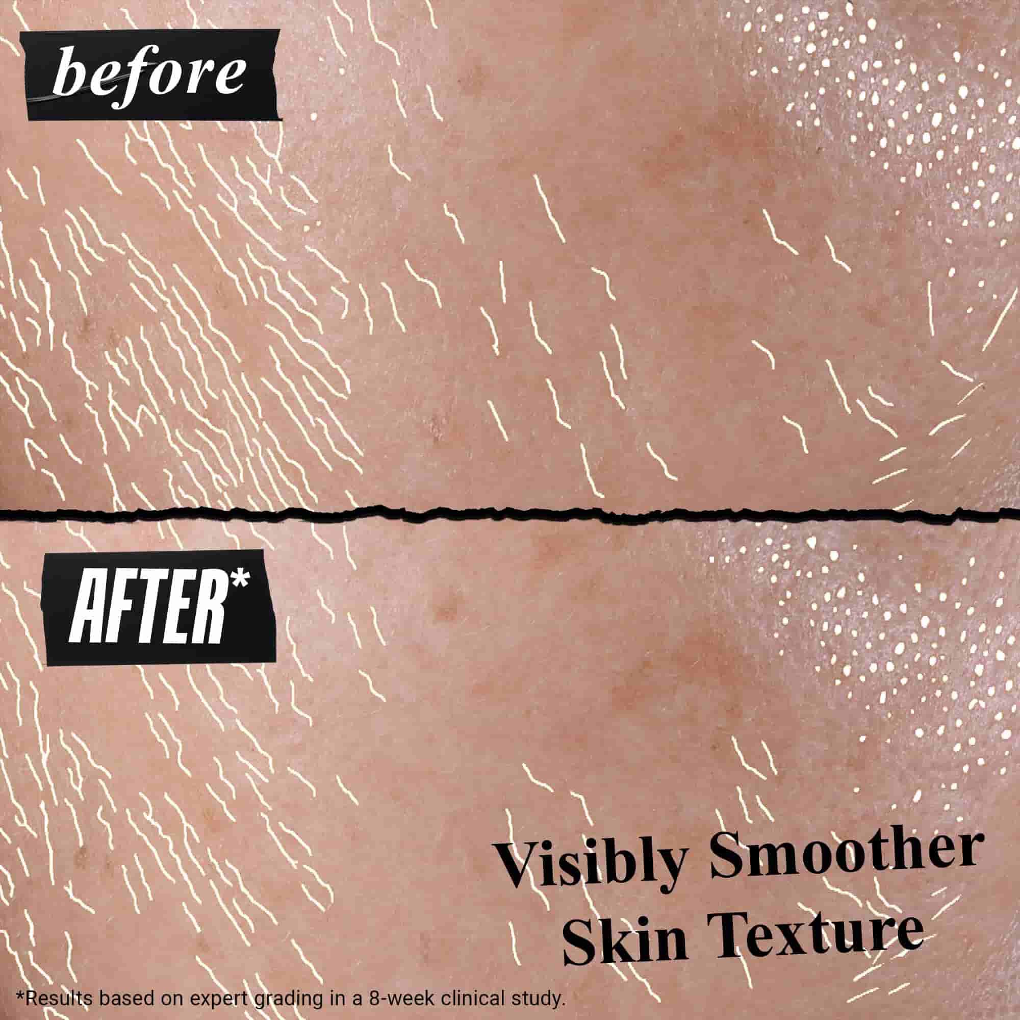 Резултати преди и след Better Screen UV Serum върху кожата