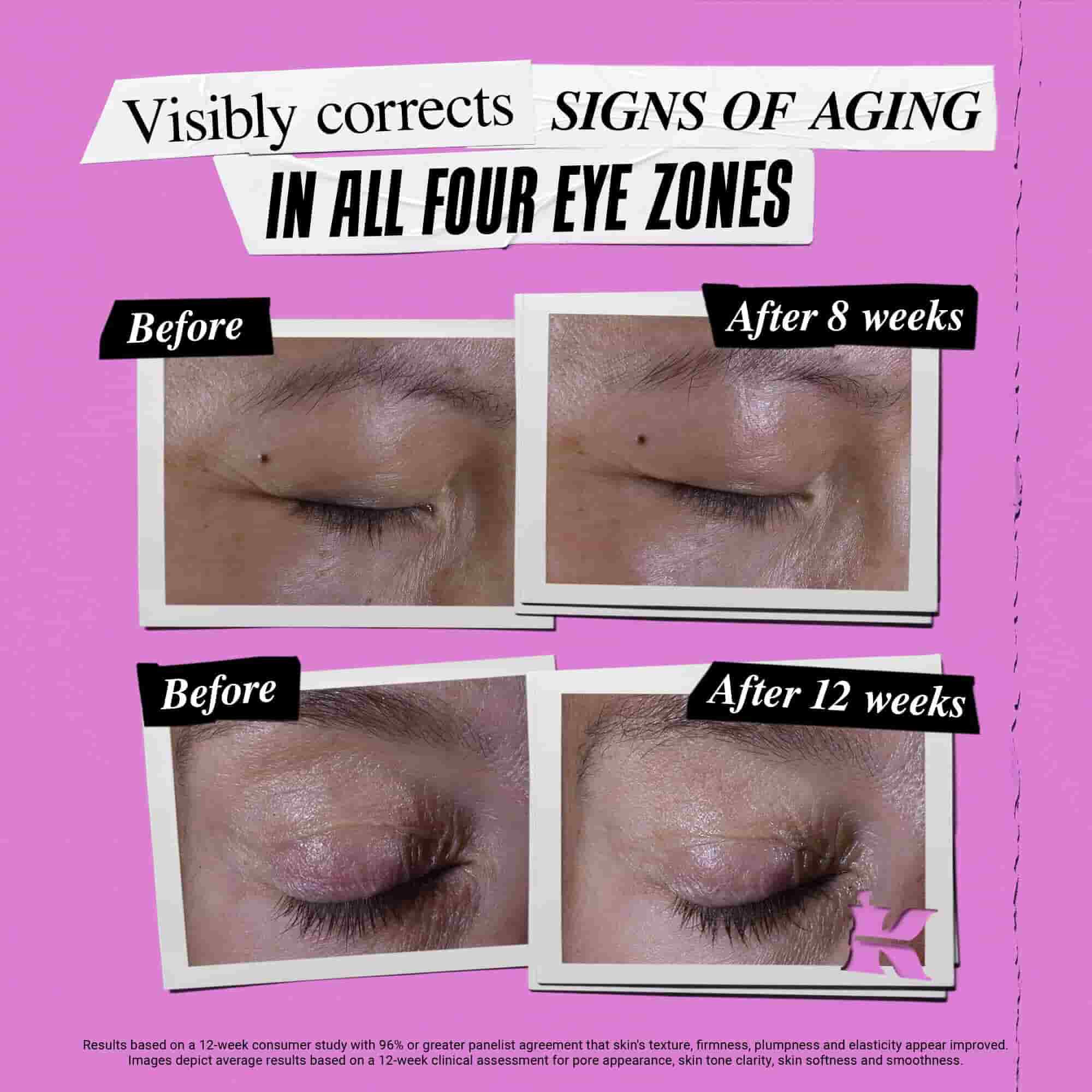 Снимка "Преди и След" за Kiehl's Super Multi-Corrective Eye Zone Treatment, коригиращ признаците на стареене