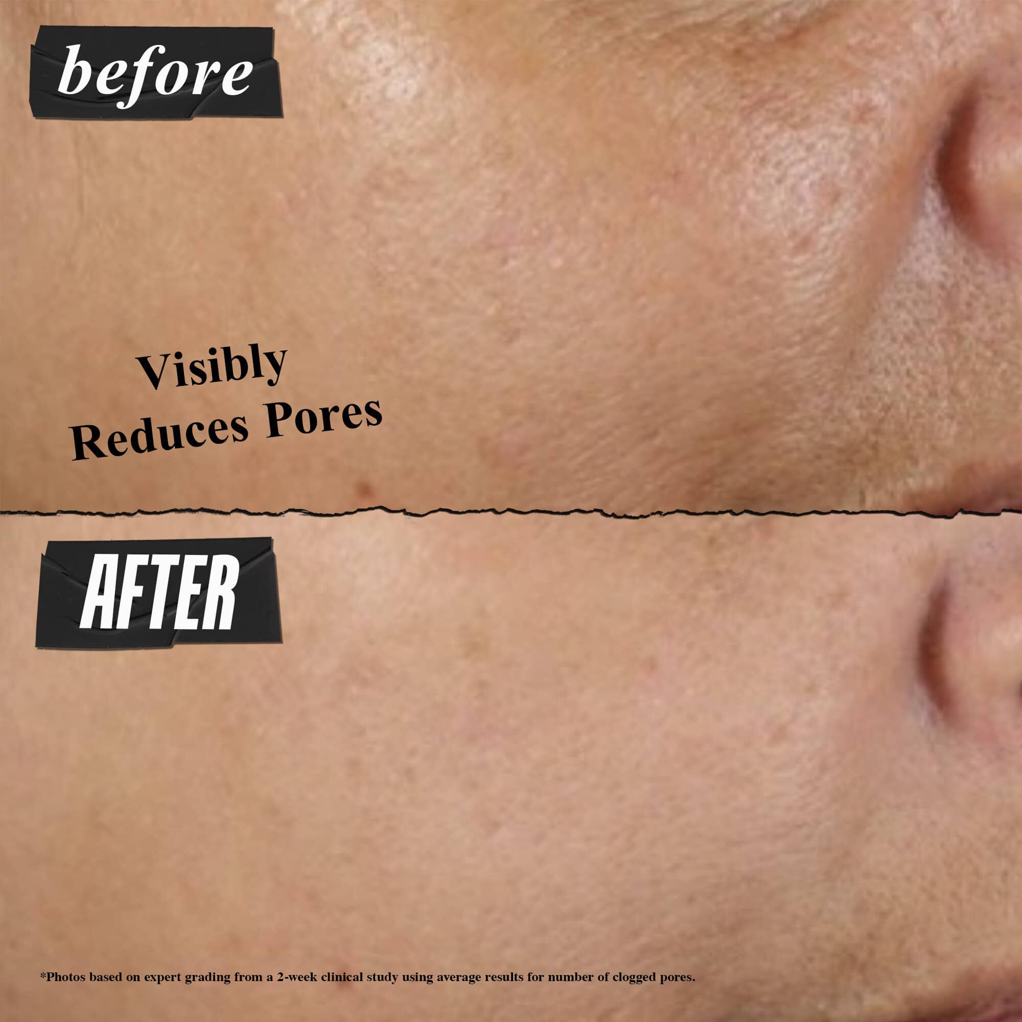 Rare Earth Deep Pore Cleansing Mask