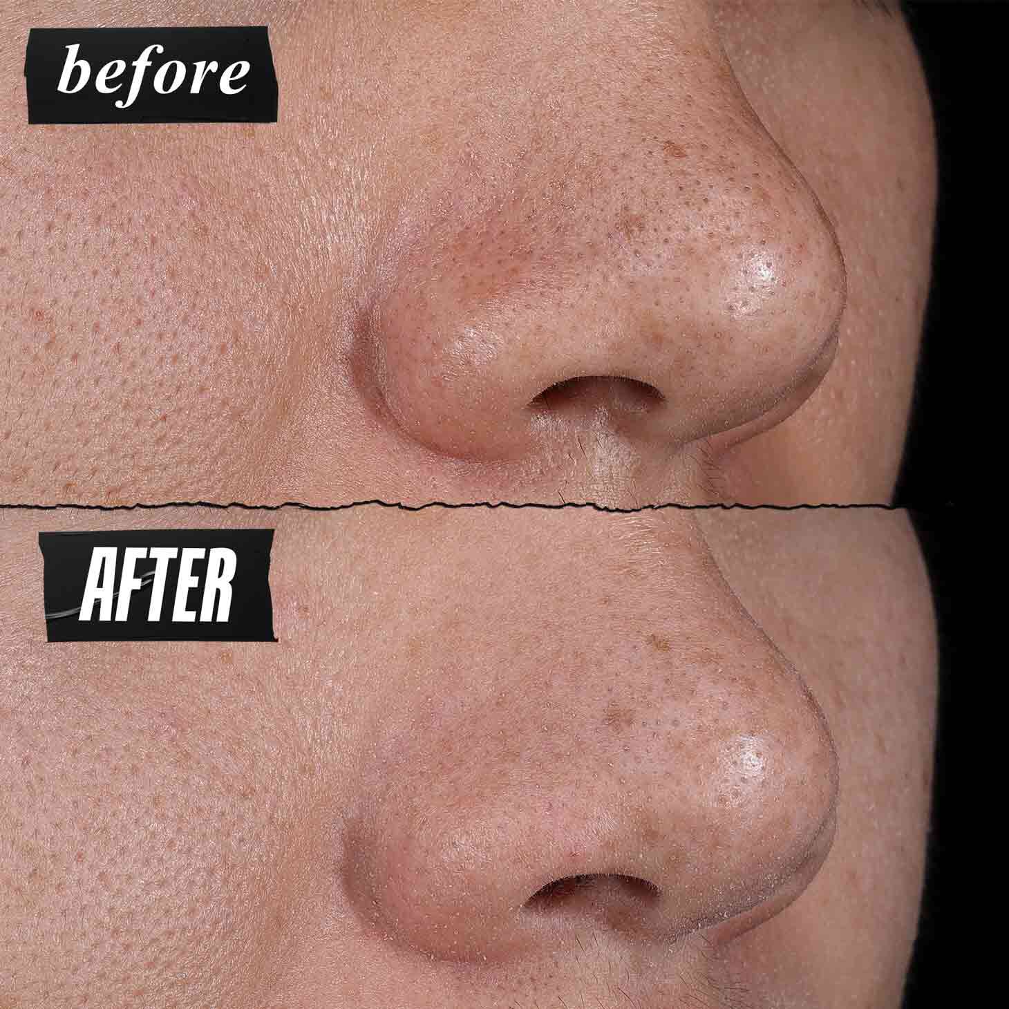 Снимка "Преди и След" – дълбоко почистващата маска Kiehl's Rare Earth видимо намалява порите