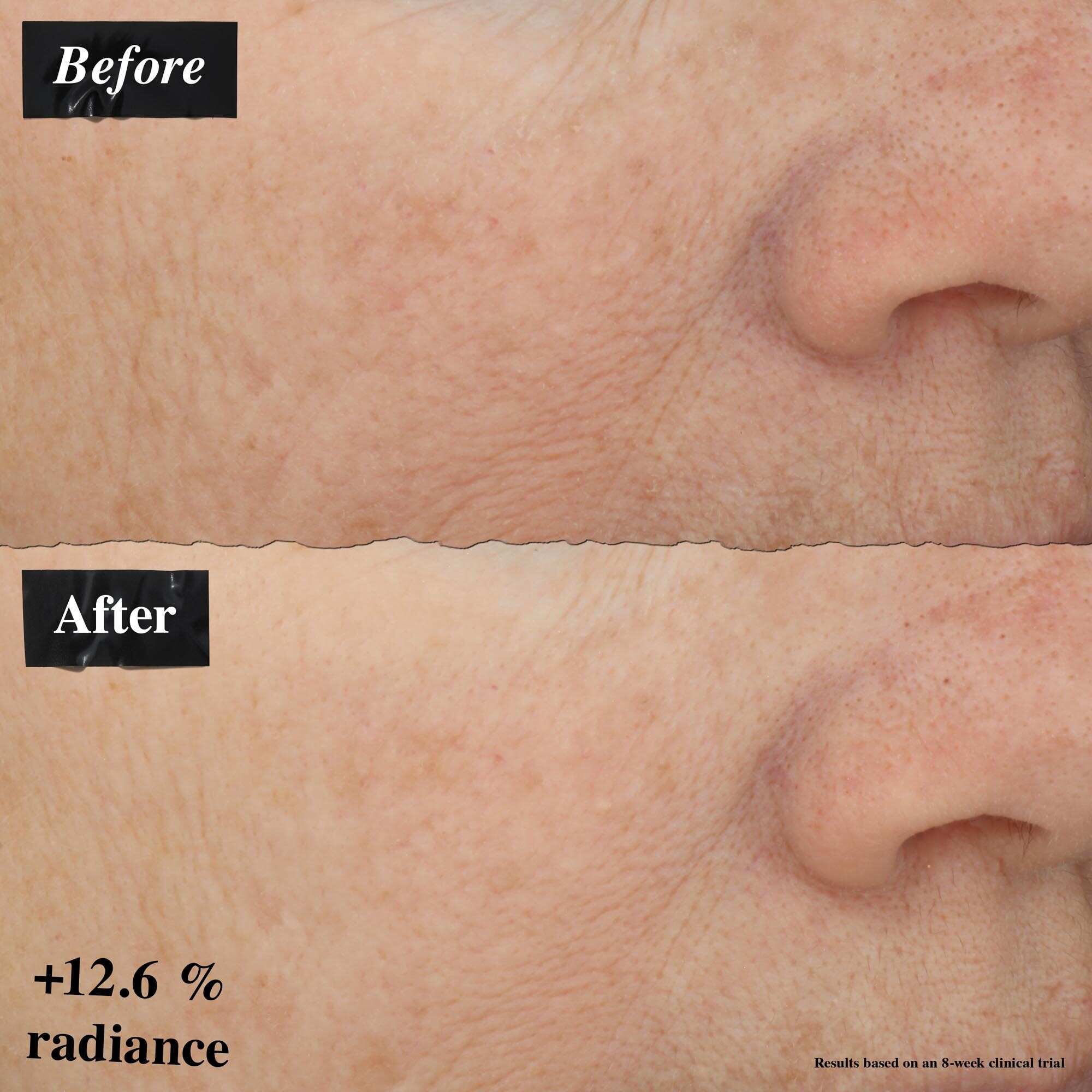 Сравнение на изображения преди и след, показващо подобрение в зачервяването на кожата след употреба на Powerful-Strength Line-Reducing Concentrate.