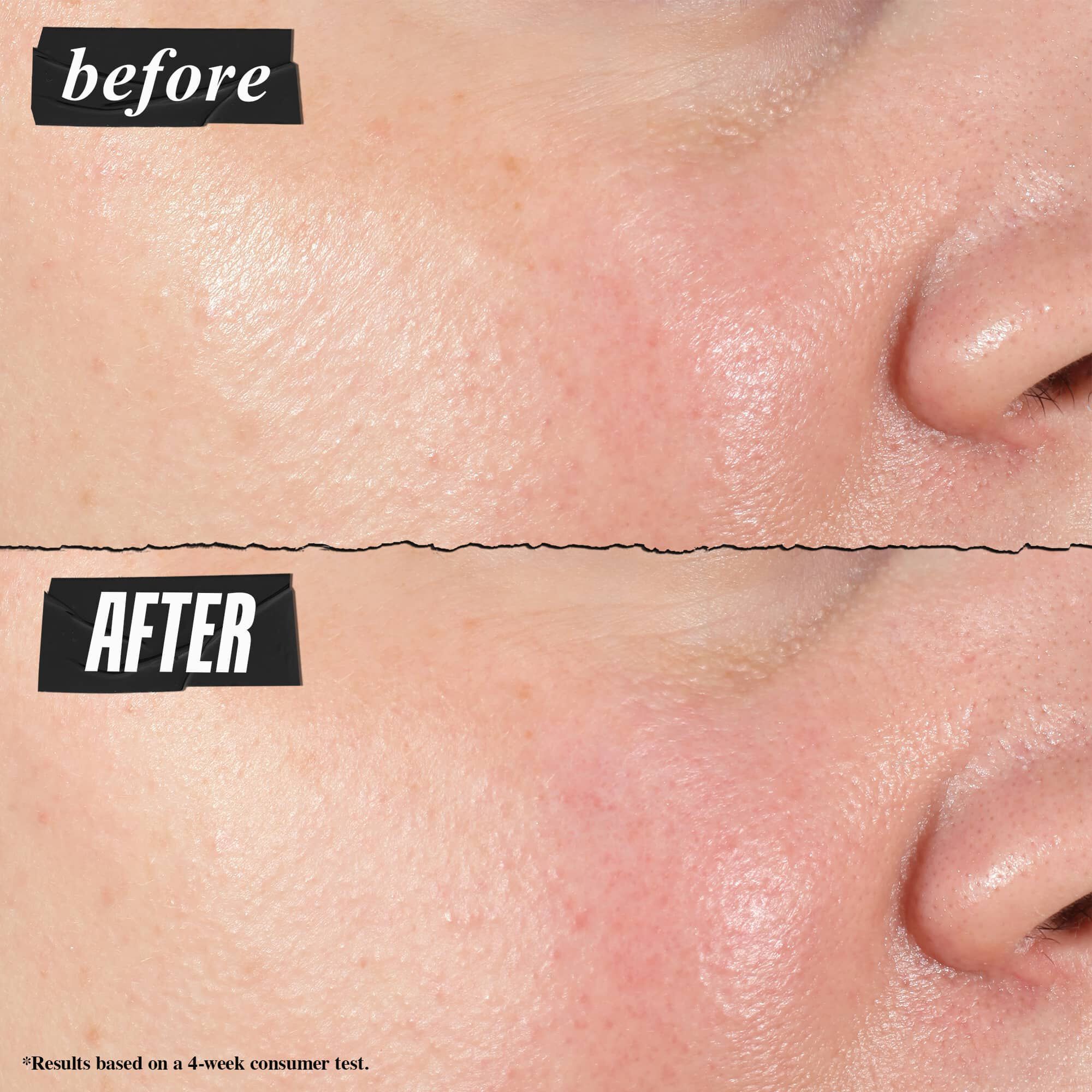 Снимка "Преди и След" – серум-концентратът Kiehl's Hydro Plumping видимо намалява порите