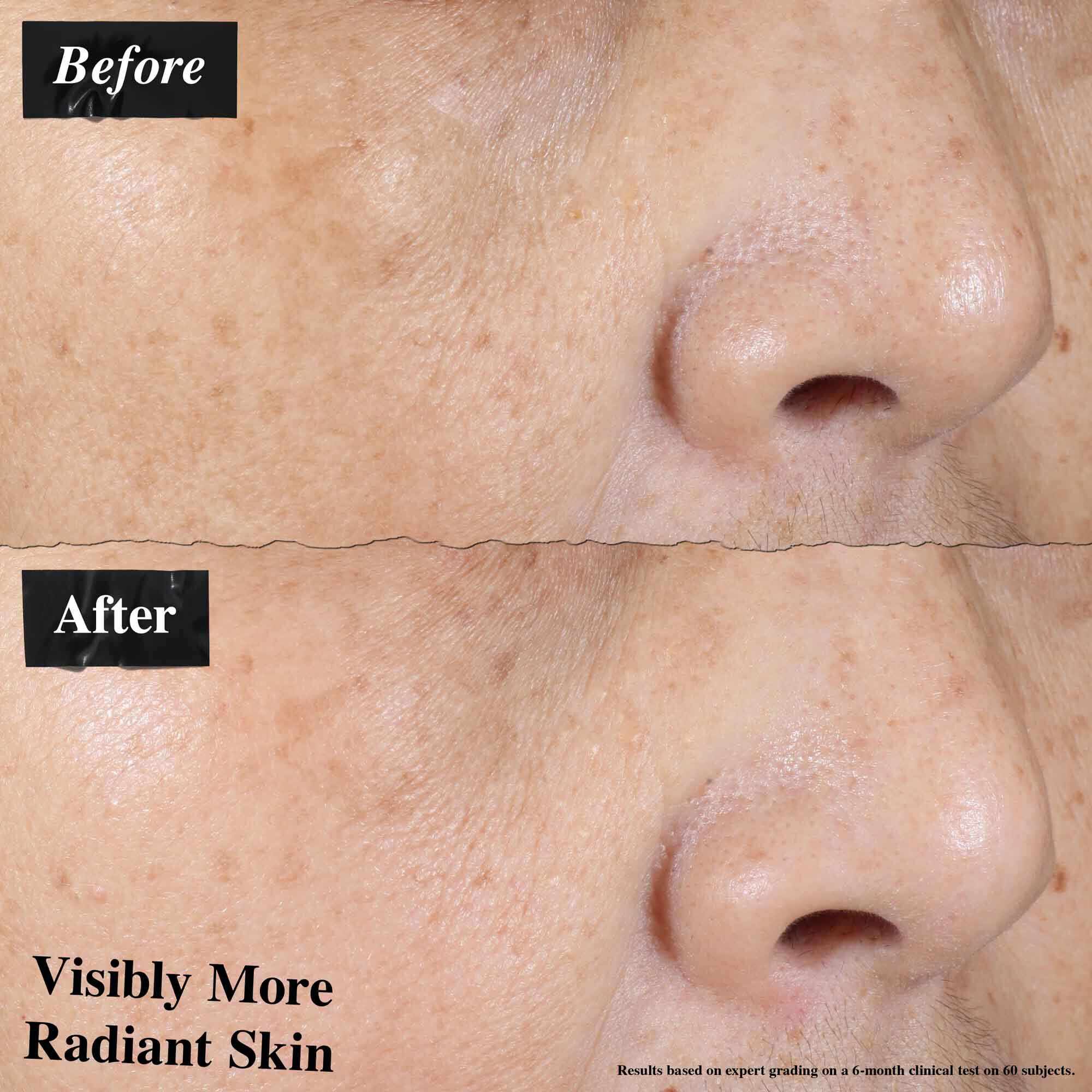 Сравнение преди и след, показващо видимо намалено зачервяване на кожата след употреба на Ultra-Light Daily UV Defense.