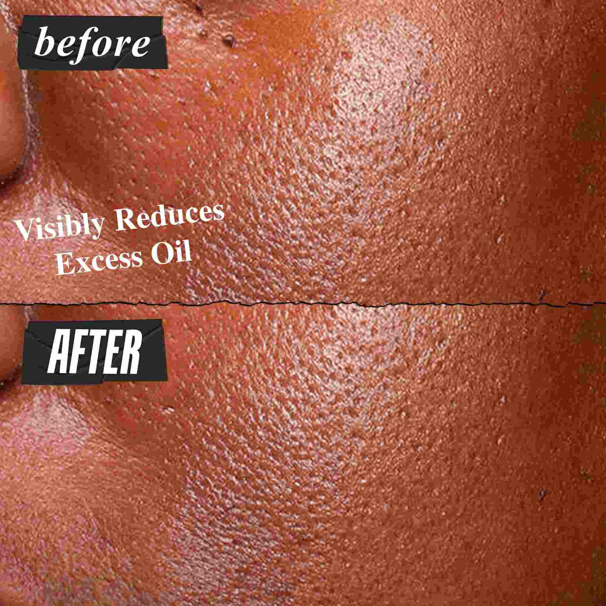 Снимка "Преди и След" на висококонцентрирания серум Kiehl's Ultra Pure, който видимо намалява излишния себум