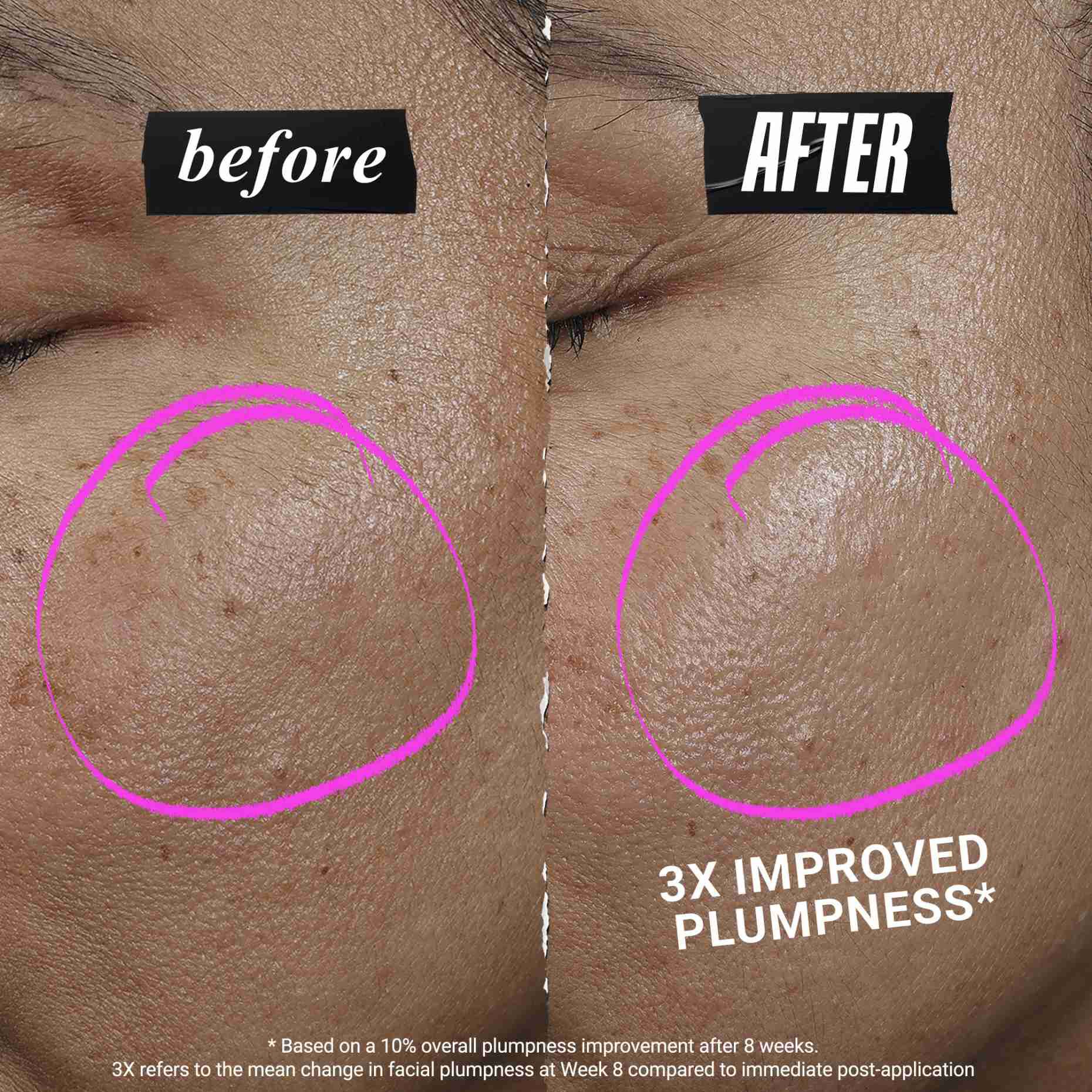 1cc* CollaShot Plump serum, серум за лице с рекомбинантен колаген за по-стегната и плътна кожа